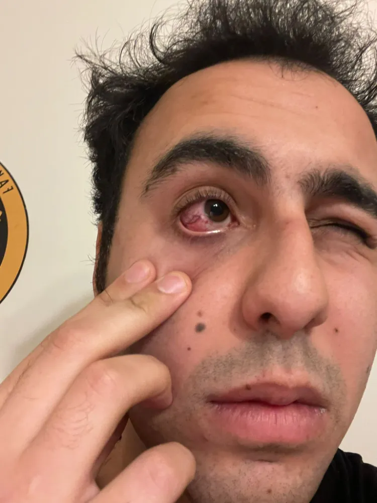  KTO Karatay Üniversitesi’nde Türk Öğrenciye Saldırı